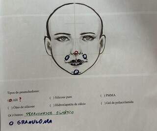 Laudo de exame indicando não ser ácido hialurônico o preenchimento no rosto de Lorena. (Foto: Arquivo pessoal)