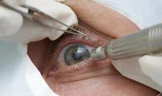 Médico oftalmologista examina olho de paciente (Foto: Agência Brasil)