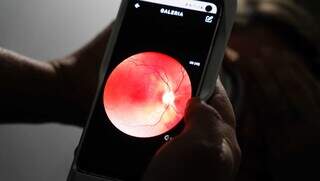 Exame avalia o fundo do olho, região afetada pela doença (Foto: Alex Machado)