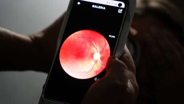 Em 2 hospitais da Capital, diagnósticos de doença que leva à cegueira aumentaram