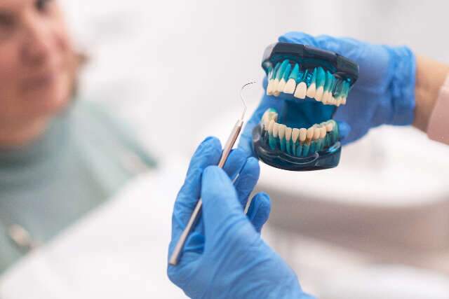 Dicas para manter os implantes dentários saudáveis