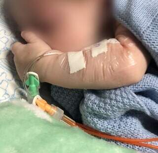 Bebê com cateter venoso em um dos braços, antes de ter sido &#34;perdido&#34; (Foto: Direto das ruas)