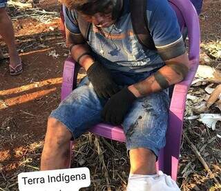 Indígena baleado na perna nesta sexta-feira (19) em Douradina (Foto: Divulgação/Cimi)