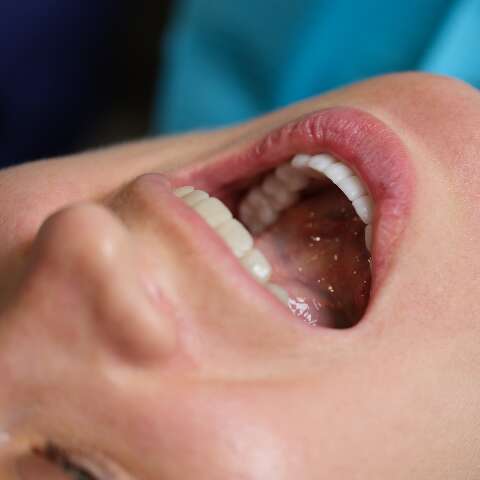 Alterações comuns na boca durante o envelhecimento
