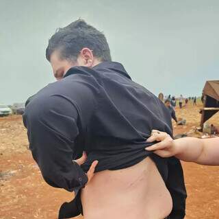August Shipman mostra costas marcadas após suposta agressaão de fazendeiros