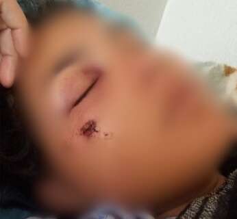 Grávida é baleada no rosto durante atentado na Vila Nasser 