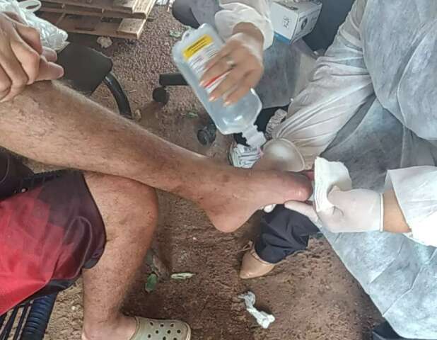 Cansado de esperar em fila de cirurgia, homem amputa dedos sozinho 