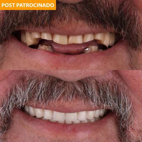 Chega de sorrisos feios: encontre o melhor tratamento para mudar sua vida