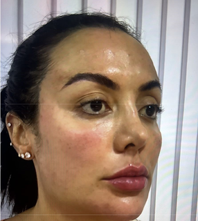 Raquel quando fez procedimento em clínica de harmonização facial e fez Pix falso no total de R$ 7 mil (Foto: Reprodução dos autos de processo) 