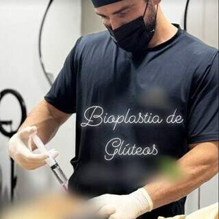 Junior Lima Bezerra posta bioplastia de glúteos em paciente (Foto/Reprodução)