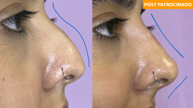 Clínica de estética inova com bonificação de até R$ 1 mil em tratamentos faciais