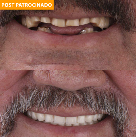 Não deixe seu sorriso para depois! Encontre o melhor tratamento para você 