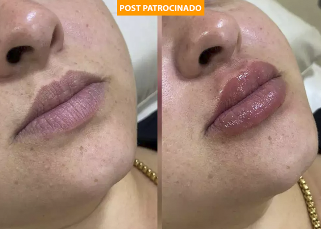 Conheça as inovações estéticas para um glow up poderoso