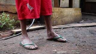 Pé de um homem que mora em uma favela de Campo Grande (Foto: arquivo/Alex Machado)