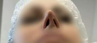 Famosa nas redes sociais, dentista acumula pedidos de indeniza&ccedil;&atilde;o por erro