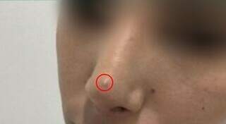 Famosa nas redes sociais, dentista acumula pedidos de indeniza&ccedil;&atilde;o por erro