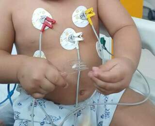 Por erro m&eacute;dico, beb&ecirc; fica 9 meses com fio met&aacute;lico no cora&ccedil;&atilde;o