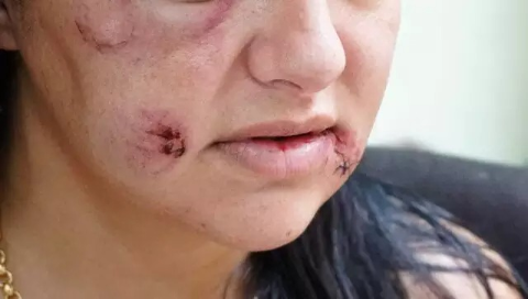 Sete em cada 10 pessoas conhecem mulher que j&aacute; foi agredida pelo parceiro