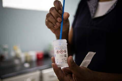 Para substituir Papanicolau, testes de DNA come&ccedil;am a ser entregues em maio