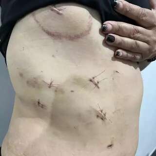Preso ex que tentou matar professora esfaqueada