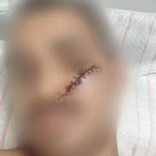 Vers&atilde;o de leg&iacute;tima defesa revolta fam&iacute;lia de jovem esfaqueado em cl&iacute;nica