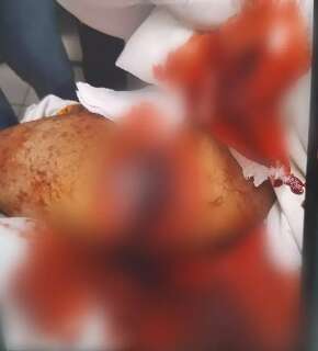 Vers&atilde;o de leg&iacute;tima defesa revolta fam&iacute;lia de jovem esfaqueado em cl&iacute;nica