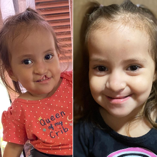 &quot;&Eacute; um al&iacute;vio&quot;: M&atilde;e comemora nova lei que garante tratamento de fenda palatina 