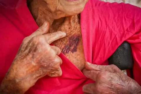 MS lidera casos de viol&ecirc;ncia contra idosos dentro da fam&iacute;lia e entre conhecidos