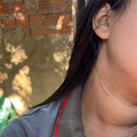  &quot;Nem com ele preso fico segura&quot;, diz mulher torturada com cabelo cortado a faca