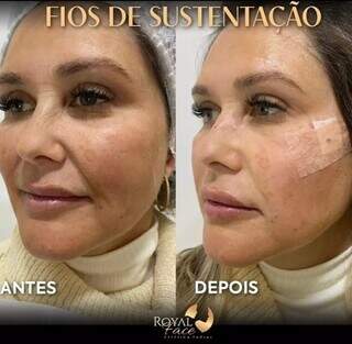 Combo mãe e filha: O Mês das Mães ainda não acabou na Royal Face Combo mãe e filha: O Mês das Mães ainda não acabou na Royal Face
