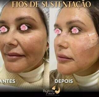 Combo m&atilde;e e filha: O M&ecirc;s das M&atilde;es ainda n&atilde;o acabou na Royal Face