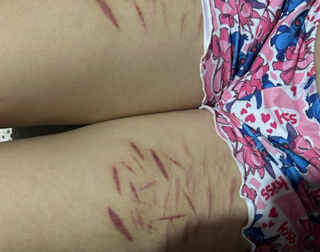 Print mostra conversa entre adolescente e v&iacute;tima:&ldquo;gostou de se cortar pro papai&rdquo;