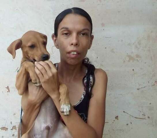 Mulher que denunciou marido por agress&atilde;o morreu por infec&ccedil;&atilde;o, aponta laudo