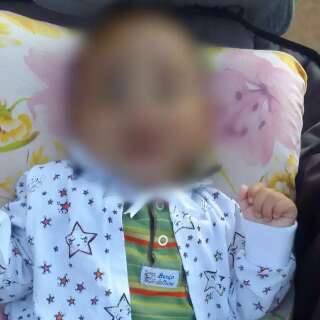 Beb&ecirc; de 6 meses morre ap&oacute;s apresentar hematoma na cabe&ccedil;a e sangramento no nariz 