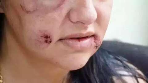 Viol&ecirc;ncia dom&eacute;stica est&aacute; entre 4 maiores ocorr&ecirc;ncias identificadas em hospitais