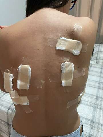 Um ano ap&oacute;s ataque, mulher ainda sofre amea&ccedil;as do ex foragido