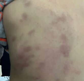 Mulher sai para trabalhar e filho de 3 anos &eacute; espancado pelo padrasto