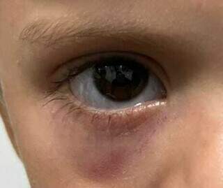 Mulher sai para trabalhar e filho de 3 anos &eacute; espancado pelo padrasto