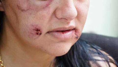 MS lidera taxas de feminic&iacute;dio e estupro no Pa&iacute;s