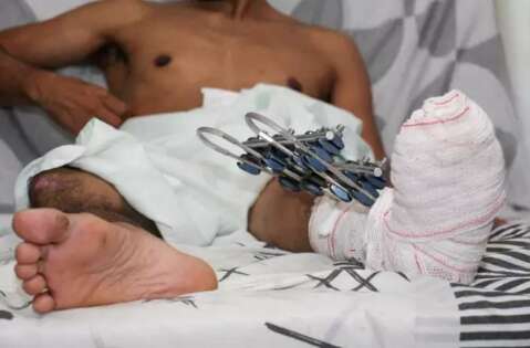 Amputa&ccedil;&atilde;o, viuvez e espera por per&iacute;cia h&aacute; 6 meses: o calv&aacute;rio de Jo&atilde;o em MS