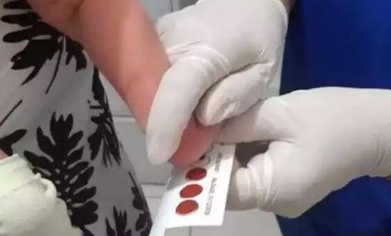 MS lança plano para ampliar diagnóstico e atendimento de Doença Falciforme