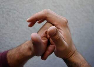 Estalar os dedos com frequ&ecirc;ncia pode levar &agrave; cirurgia?