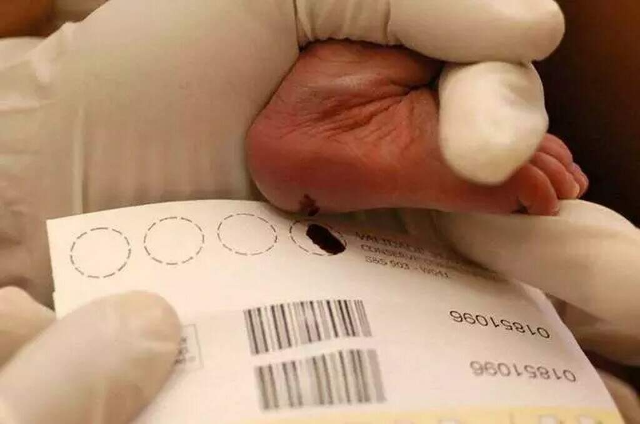 Minist&eacute;rio da Sa&uacute;de aumenta em 30% recursos para teste do pezinho