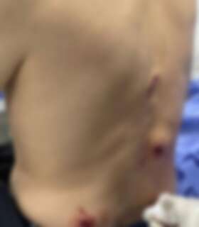 Motociclistas disparam tr&ecirc;s vezes contra homem na fronteira