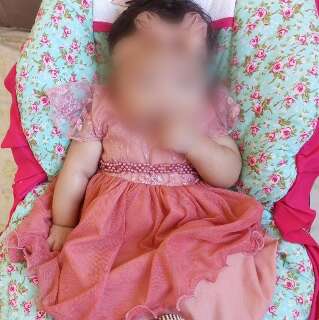 Fam&iacute;lia corre contra o tempo para salvar bra&ccedil;o de beb&ecirc; v&iacute;tima de les&atilde;o no parto