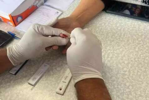 MS registra aumento de 14% nos casos de HIV com 130 diagn&oacute;sticos em 2024