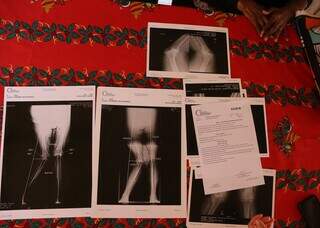 Ap&oacute;s empr&eacute;stimo de R$ 10 mil, Rosimeire v&ecirc; cirurgia negada por erro em processo