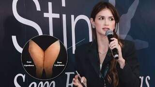 Tem lipedema? Entenda os sinais, diagn&oacute;stico e como &eacute; feito o tratamento