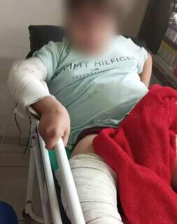 Menino com "ossos de vidro" aguarda há 3 dias por vaga em hospital após fratura Menino com "ossos de vidro" aguarda há 3 dias por vaga em hospital após fratura