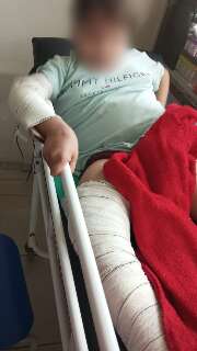 Menino com &quot;ossos de vidro&quot; aguarda h&aacute; 3 dias por vaga em hospital ap&oacute;s fratura